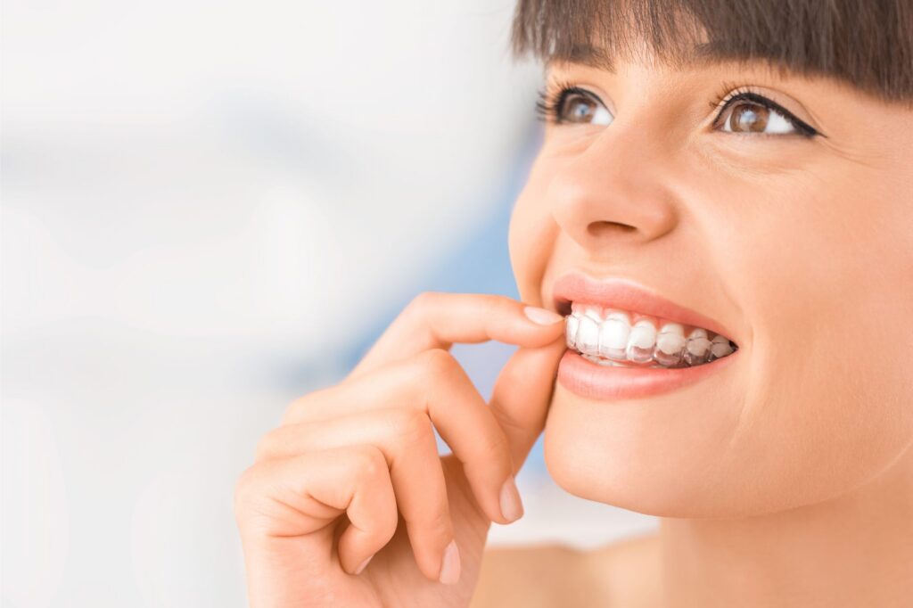 Clear Aligners in Cedar Rapids